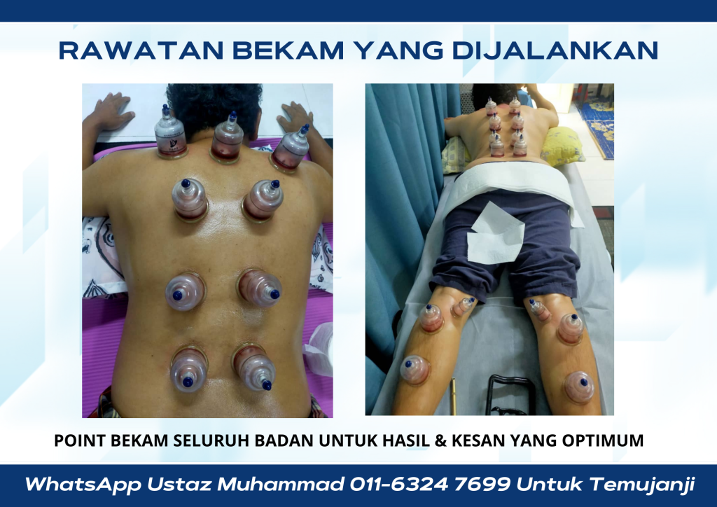 pusat terapi bekam hijamah merawat kesihatan tubuh dengan buang darah kotor dan toksin dengan khidmat bekam dari rumah ke rumah di perling