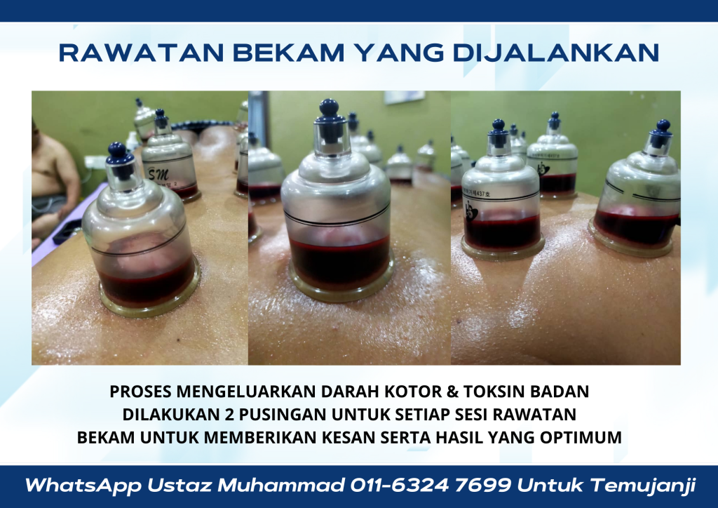 tukang bekam jurubekam terlatih bertauliah rawatan bekam al fashdu buang darah kotor rawat penyakit di taman daya